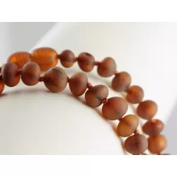 Raw Cherry Baltic Amber Anklets 25cm