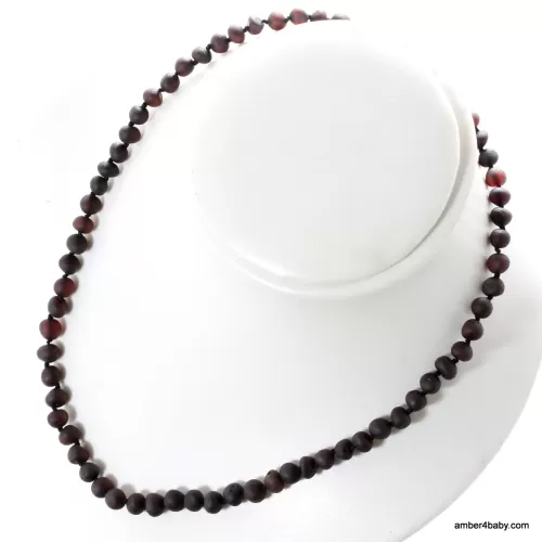 Cherry Baroque Baltic Amber Necklace for Adults